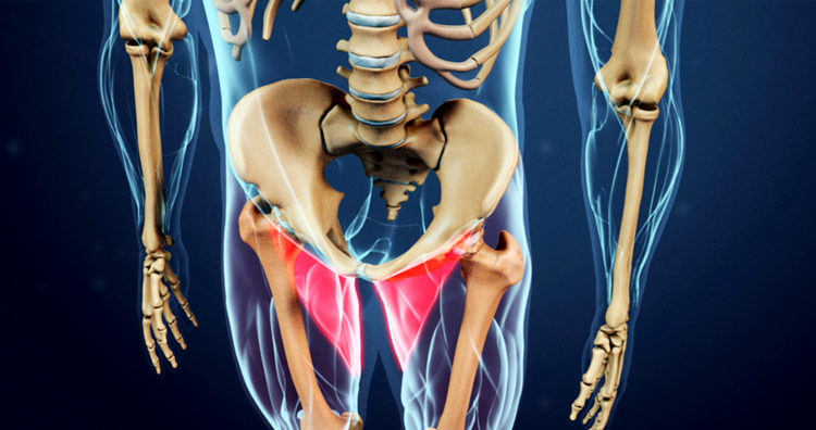 Groin Pain Due to Herniated Disc - DiscSeel - Non-Surgical Spine Procedure