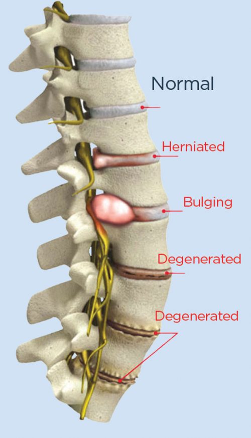 spine_conditions_2