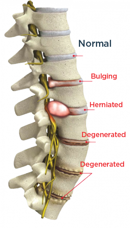 spine_conditions_3